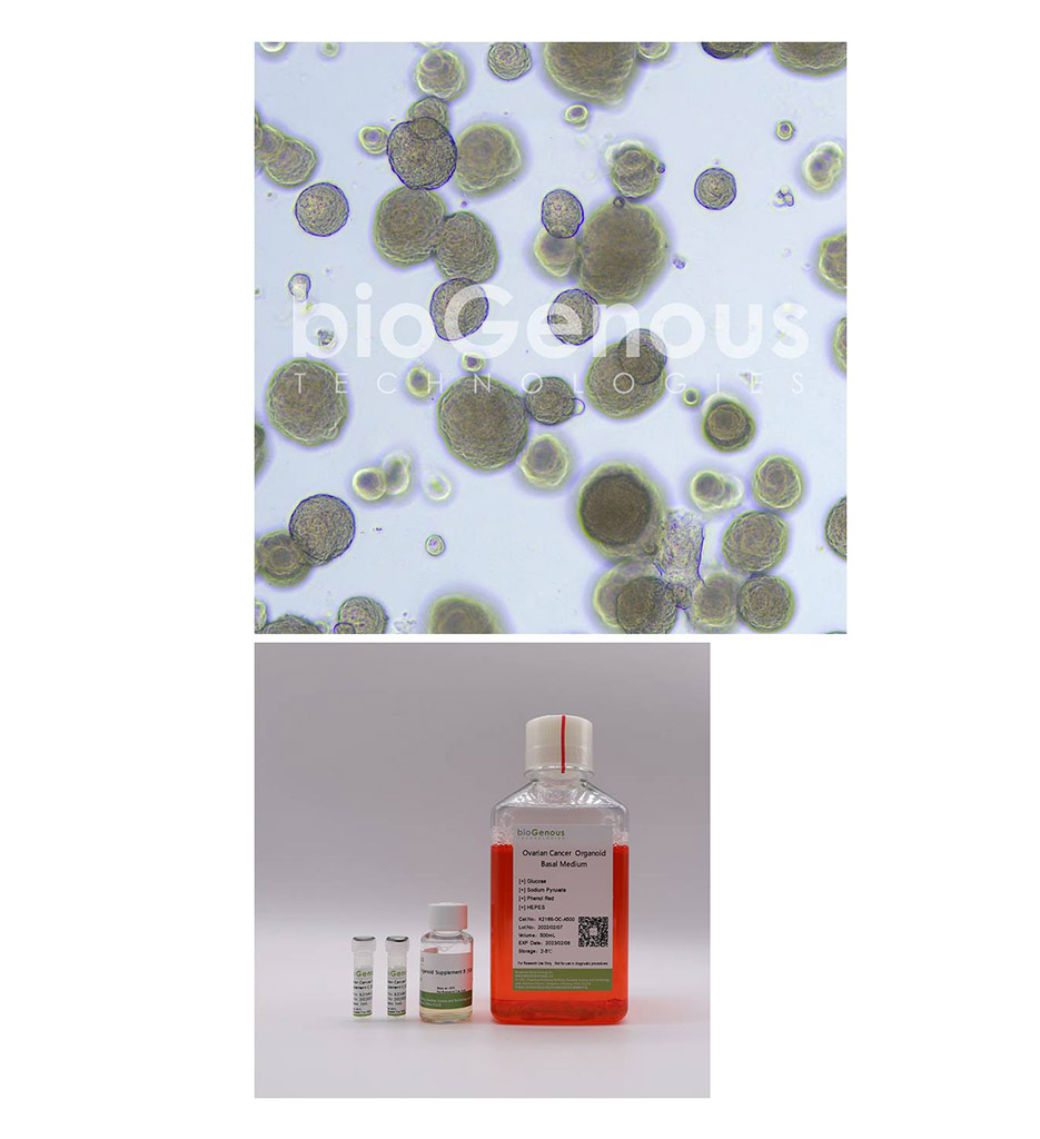 Ovarian Cancer Organoid Kit卵巢癌