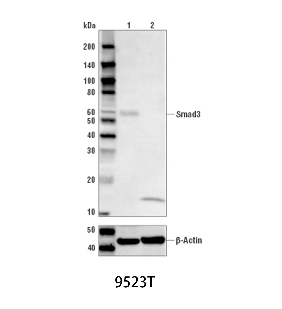 Smad3 (C67H9) Rabbit mAb