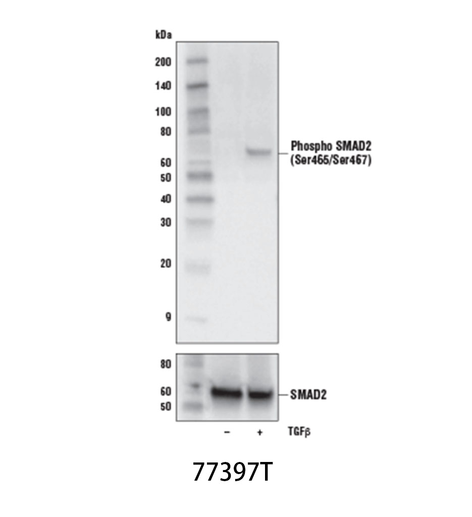 TGF-β Fibrosis Pathway Antibody Sampler Kit