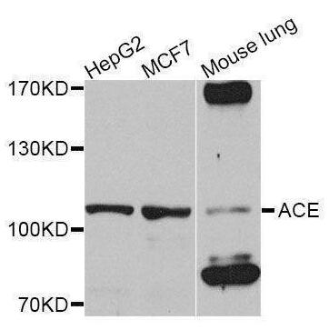Rabbit anti-ACE Antibody
