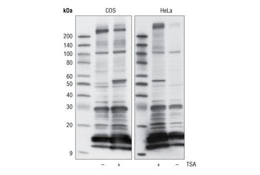Acetylated-Lysine (Ac-K<sup>2</sup>-100) MultiMab Rabbit mAb mix