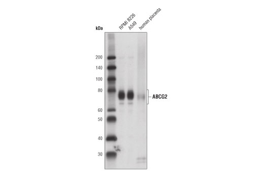 ABCG2 (D5V2K) XP Rabbit mAb