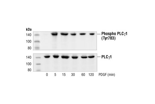 Phospho-PLCγ1 (Tyr783) Antibody