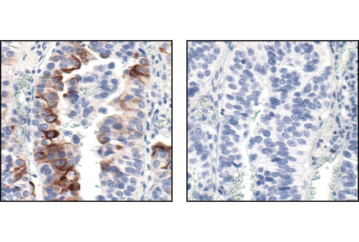 Phospho-mTOR (Ser2448) (49F9) Rabbit mAb (IHC Specific)