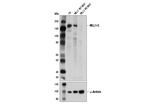 MLL1 (D6G8N) Rabbit mAb (Carboxy-terminal Antigen)