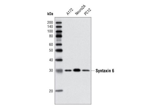 Vesicle Trafficking Antibody Sampler Kit