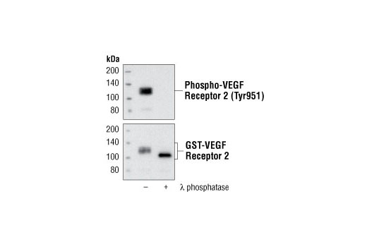 Phospho-VEGF Receptor 2 (Tyr951) (15D2) Rabbit mAb