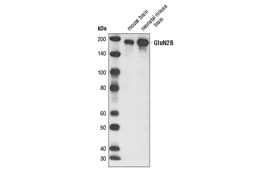NMDA Receptor 2B (GluN2B) (D15B3) Rabbit mAb