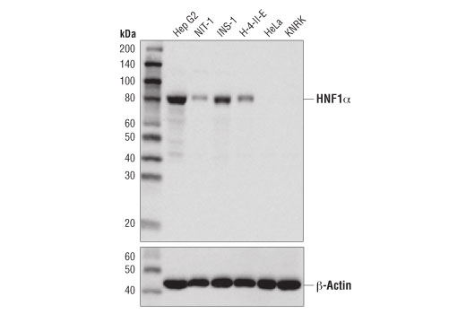HNF1α (D7Z2Q) Rabbit mAb