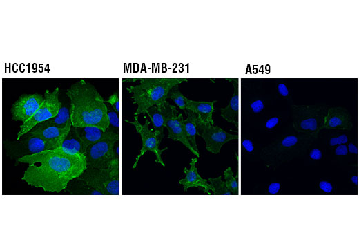 PD-L1 (Extracellular Domain Specific) (D8T4X) Rabbit mAb