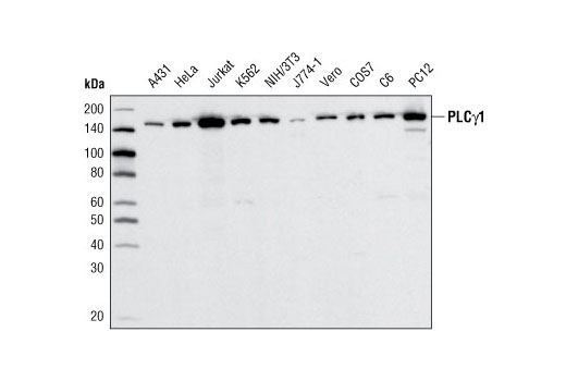 PLCγ1 (D9H10) XP Rabbit mAb