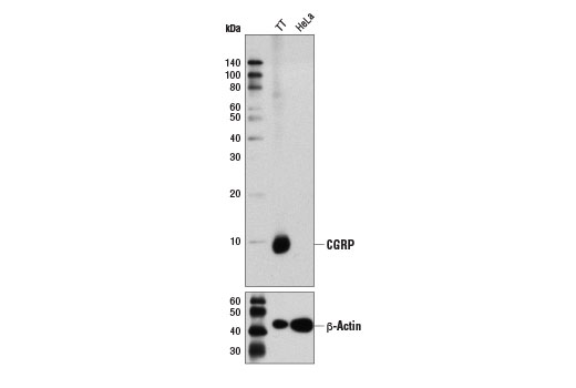 CGRP (D5R8F) Rabbit mAb