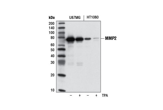 MMP-2 (D8N9Y) Rabbit mAb