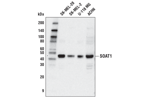 SOAT1 Antibody