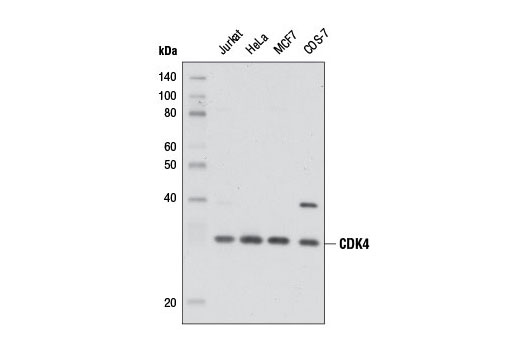 CDK Antibody Sampler Kit