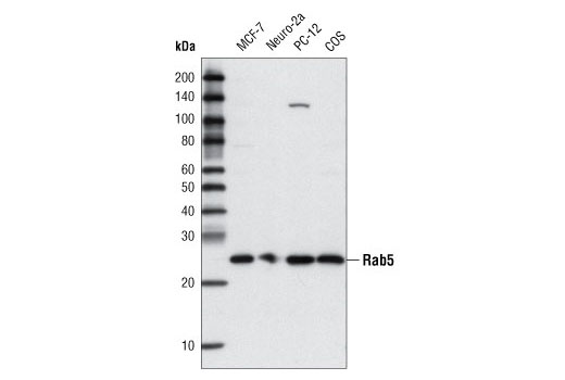 Rab5 (C8B1) Rabbit mAb