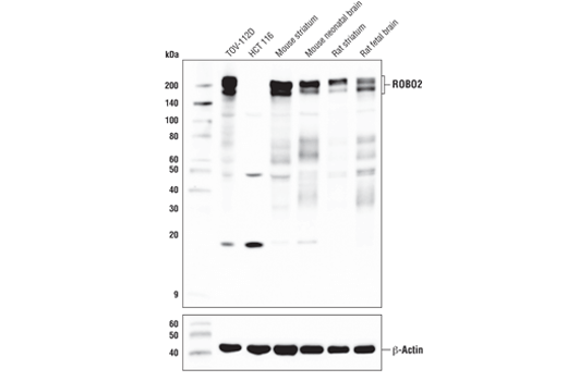 ROBO2 (E4M6D) Rabbit mAb