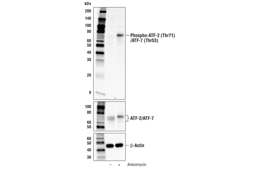 Phospho-ATF-2 (Thr71)/ATF-7 (Thr53) Antibody