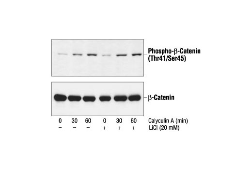 Phospho-β-Catenin (Thr41/Ser45) Antibody