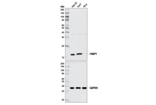 FABP1 (D2A3X) XP Rabbit mAb