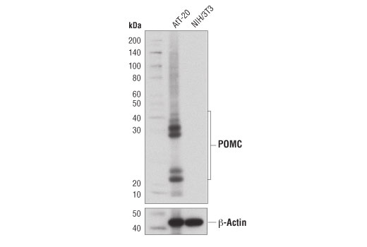 POMC (D3R1U) Rabbit mAb