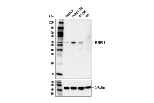 MMP-13 (E4W3T) Rabbit mAb