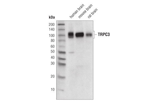 TRPC3 (D4P5S) Rabbit mAb