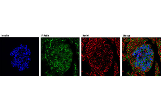 Insulin (C27C9) Rabbit mAb (Alexa Fluor 647 Conjugate)