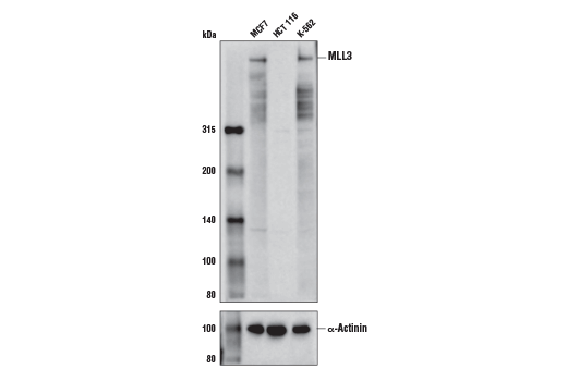 MLL3 (D1S1V) Rabbit mAb