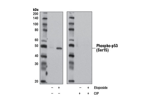 Phospho-p53 (Ser15) (D4S1H) Rabbit mAb (Rodent Specific)