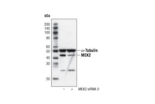 MEK2 (13E3) Rabbit mAb
