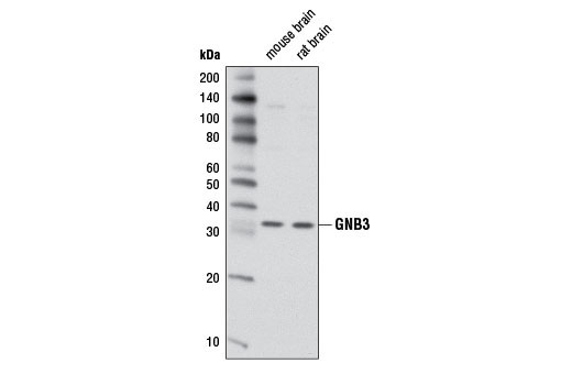 GNB3 Antibody