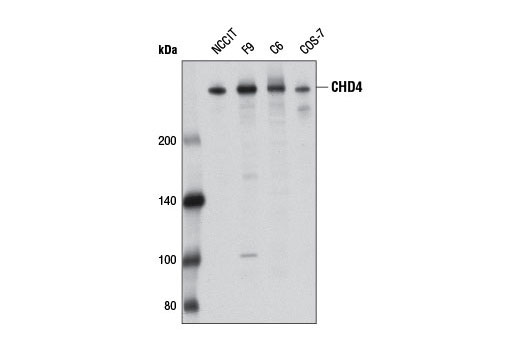 CHD4 (D4B7) Rabbit mAb