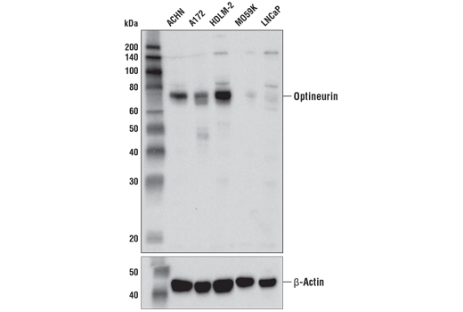 Optineurin (D2L8S) Rabbit mAb