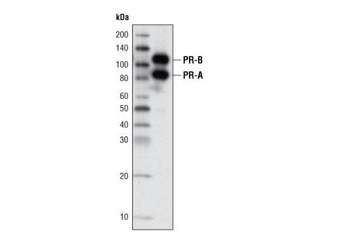 Progesterone Receptor A/B (C89F7) Rabbit mAb