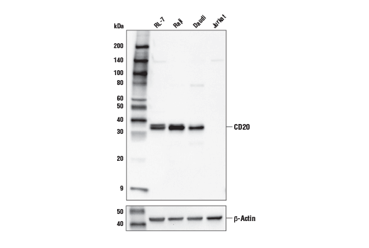 CD20 (E7B7T) XP Rabbit mAb