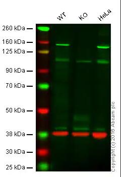 Anti-Brd4 antibody [EPR5150(2)]