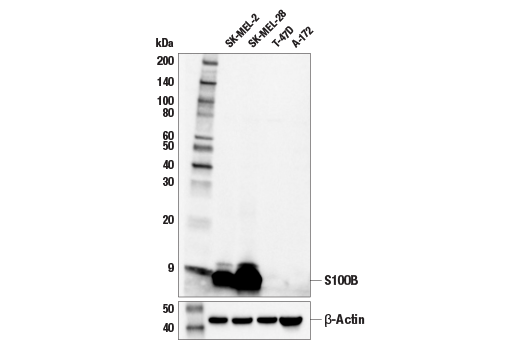 S100B (E7C3A) Rabbit Monoclonal Antibody
