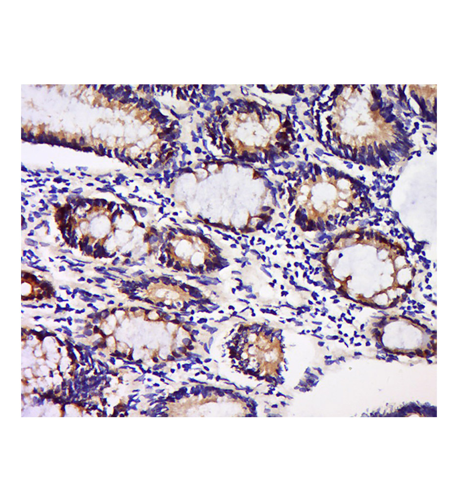 GDNF家族受体a-1抗体