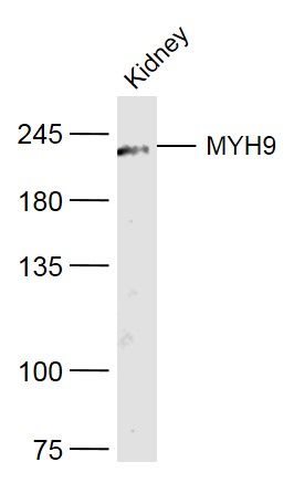 肌球蛋白重链9抗体