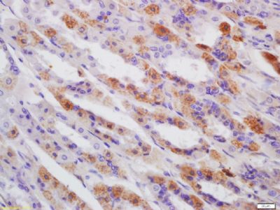 腺嘌呤磷酸核糖转移酶抗体