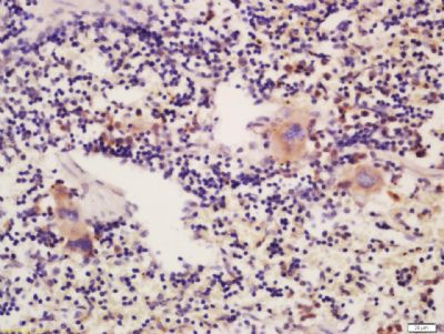 血小板跨膜反应蛋白1抗体