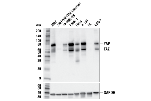 YAP/TAZ (E9M8G) Rabbit mAb