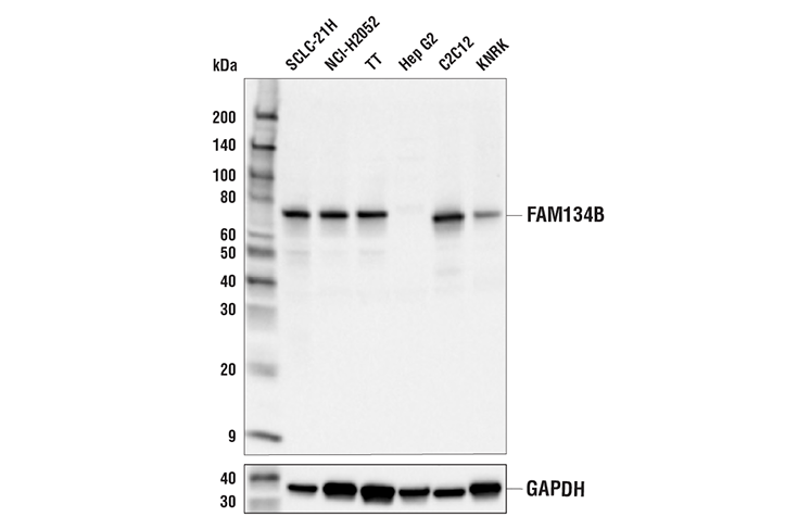 FAM134B (E8Y9R) Rabbit mAb