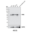PKM2 (D78A4) XP Rabbit mAb