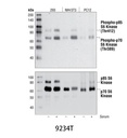 Phospho-p70 S6 Kinase (Thr389) (108D2) Rabbit mAb