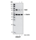 Stat3 (79D7) Rabbit mAb