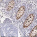 Anti-Sp7 / Osterix antibody - ChIP Grade