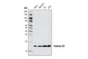 Methyl-Histone H3 (Lys4) Antibody Sampler Kit
