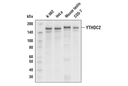 YTHDC2 Antibody